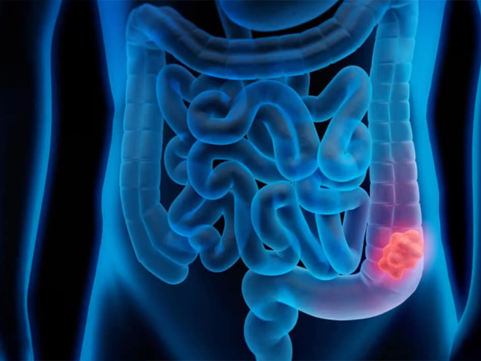 crc-blog-5-9-2022 crc-blog-5-9-2022