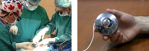 Image source: https://sunnybrook.ca/content/?page=colorectal-colon-bowel-haip-chemotherapy